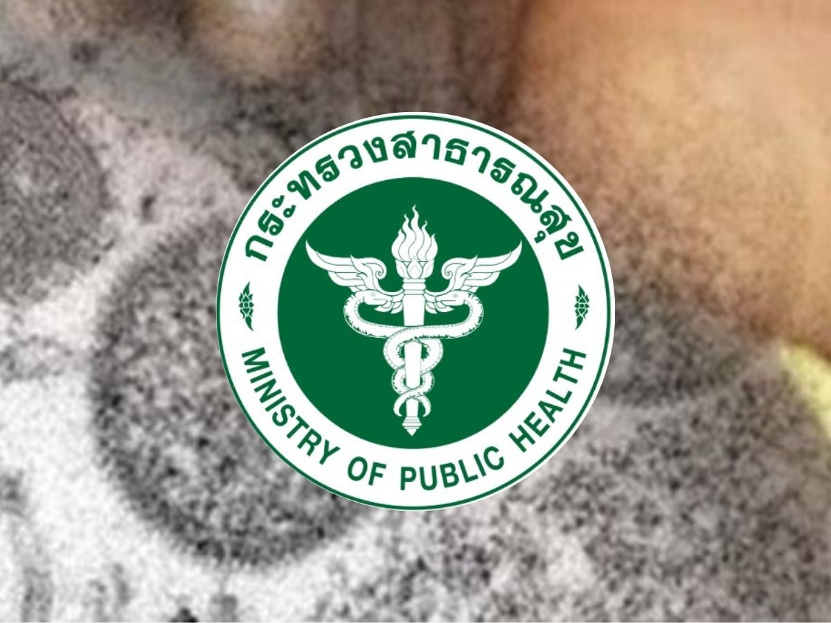กรมควบคุมโรค เผยผู้ป่วย ‘ฝีดาษลิง’ ในเรือนจำเสียชีวิต เร่งเฝ้าระวังกลุ่มเสี่ยง 46 ราย